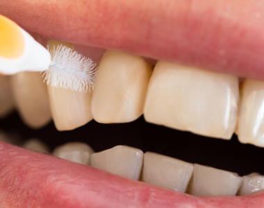 Cleaning between teeth: the secret behind a healthy smile - treatment at westharbor dental  